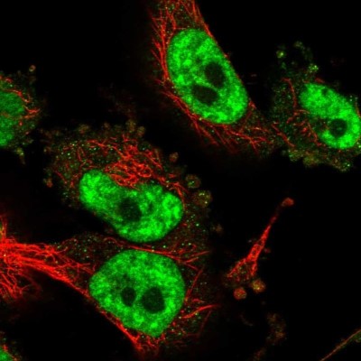 Immunocytochemistry/Immunofluorescence: CD2BP2 Antibody [NBP2-47516] - Staining of human cell line U-251 MG shows localization to nuclear speckles & cytosol.