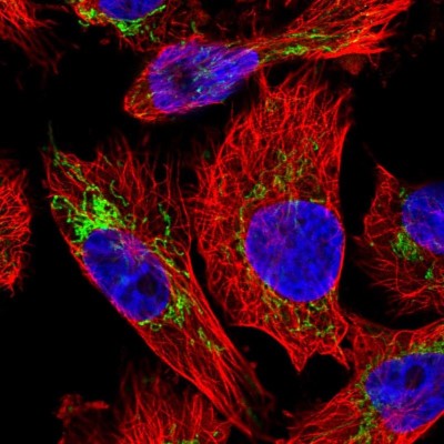 Immunocytochemistry/Immunofluorescence: PYCR2 Antibody [NBP2-47318] - Immunofluorescent staining of human cell line U-251 MG shows localization to mitochondria.