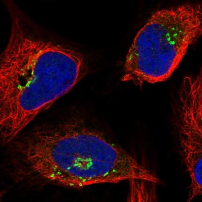 Immunocytochemistry/Immunofluorescence: OSBP1 Antibody [NBP2-47343] - Immunofluorescent staining of human cell line U-2 OS shows localization to the Golgi apparatus.