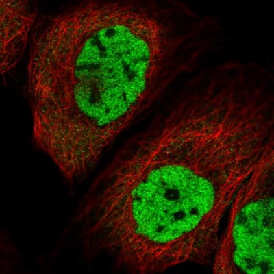 Immunocytochemistry/Immunofluorescence: MORN3 Antibody [NBP2-31007] - Immunofluorescent staining of human cell line A-431 shows localization to nucleoplasm.