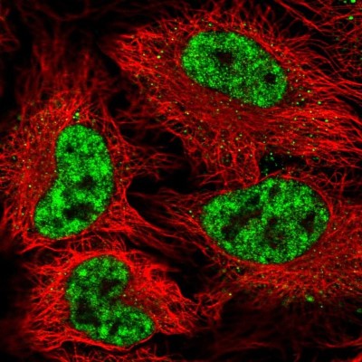 Immunocytochemistry/Immunofluorescence: SAP155 Antibody [NBP2-47291] - Immunofluorescent staining of human cell line HeLa shows localization to nuclear speckles.
