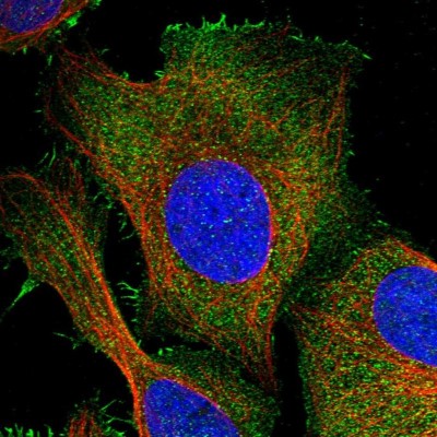 Immunocytochemistry/Immunofluorescence: PKD2L2 Antibody [NBP2-47332] - Immunofluorescent staining of human cell line U-2 OS shows localization to plasma membrane & cytosol.