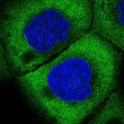 Immunocytochemistry/Immunofluorescence: EIF3J Antibody [NBP2-13953] - Immunofluorescent staining of human cell line A-431 shows localization to cytosol.