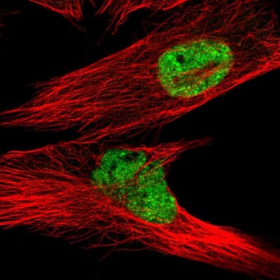 Immunocytochemistry/Immunofluorescence: LPPR2 Antibody [NBP2-14253] - Staining of human cell line U-251 MG shows localization to nucleoplasm.