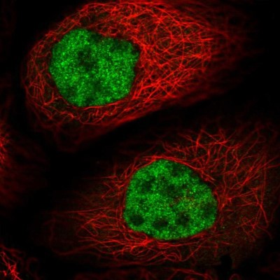 Immunocytochemistry/Immunofluorescence: NIP30 Antibody [NBP2-13988] - Immunofluorescent staining of human cell line A-431 shows localization to nucleoplasm.
