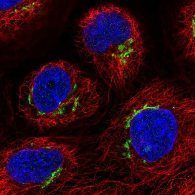 Immunocytochemistry/Immunofluorescence: FAM3C Antibody [NBP2-13996] - Immunofluorescent staining of human cell line A-431 shows localization to the Golgi apparatus.