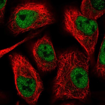 Immunocytochemistry/Immunofluorescence: TIMM50 Antibody [NBP2-38791] - Immunofluorescent staining of human cell line A549 shows localization to nucleoplasm.