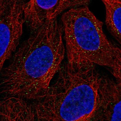 Immunocytochemistry/Immunofluorescence: PLA2G12B Antibody [NBP2-31685] - Staining of human cell line U-2 OS shows localization to vesicles.
