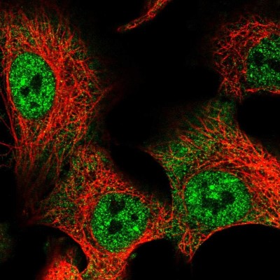 Immunocytochemistry/Immunofluorescence: RBPMS Antibody [NBP2-33810] - Immunofluorescent staining of human cell line A549 shows localization to nucleoplasm & cytosol.