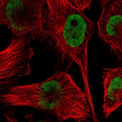 Immunocytochemistry/Immunofluorescence: HNRPDL Antibody [NBP2-38806] - Immunofluorescent staining of human cell line U-251 MG shows localization to nucleoplasm.