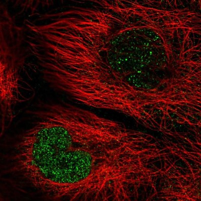Immunocytochemistry/Immunofluorescence: TNFAIP8 Antibody [NBP2-33814] - Immunofluorescent staining of human cell line A-431 shows localization to nucleoplasm.