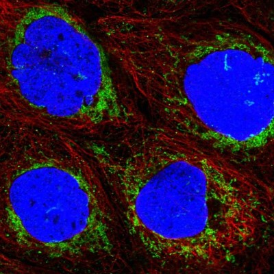 Immunocytochemistry/Immunofluorescence: ACAD9 Antibody [NBP1-82749] - Immunofluorescent staining of human cell line A-431 shows localization to mitochondria.