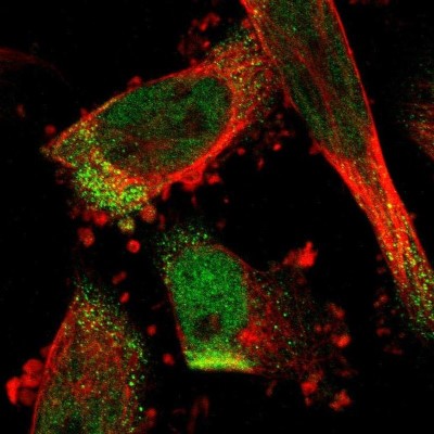 Immunocytochemistry/Immunofluorescence: C17orf80 Antibody [NBP1-83637] - Staining of human cell line U-251 MG shows localization to nucleoplasm & vesicles.