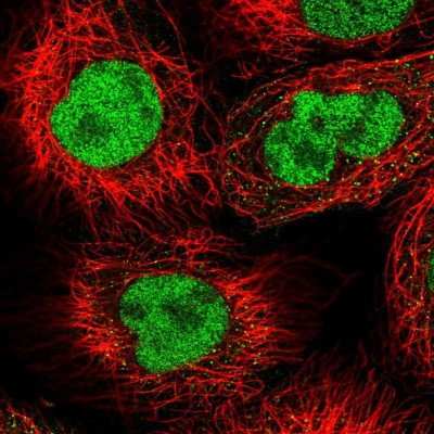 Immunocytochemistry/Immunofluorescence: CHD1L Antibody [NBP1-89154] - Immunofluorescent staining of human cell line A-431 shows localization to nucleoplasm.