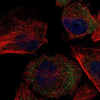 Immunocytochemistry/Immunofluorescence: TRMT61B Antibody [NBP1-83640] - Staining of human cell line U-251MG shows positivity in vesicles.