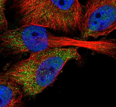 Immunocytochemistry/Immunofluorescence: ABHD2 Antibody [NBP1-82850] - Staining of human cell line U-251 MG shows localization to nucleoplasm & cytosol.