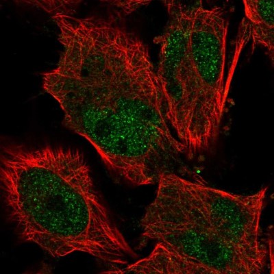 Immunocytochemistry/Immunofluorescence: KIF9 Antibody [NBP1-82773] - Immunofluorescent staining of human cell line U-251 MG shows localization to nucleoplasm & nucleoli.