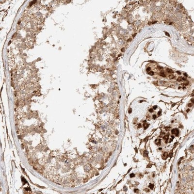 Immunocytochemistry/Immunofluorescence: KIF9 Antibody [NBP1-82773] - Staining of human testis shows cytoplasmic positivity in  cells in seminiferous ducts and Leydig cells.