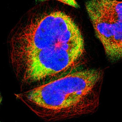 Immunocytochemistry/Immunofluorescence: RPLP0 Antibody [NBP1-82859] - Immunofluorescent staining of human cell line A-431 shows localization to cytosol & endoplasmic reticulum.