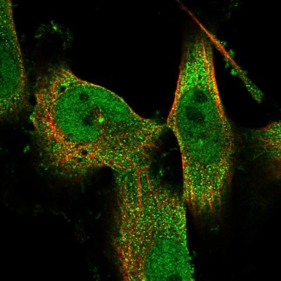 Immunocytochemistry/Immunofluorescence: C9orf40 Antibody [NBP1-90447] - Immunofluorescent staining of human cell line U-251 MG shows localization to nucleoplasm, cytosol & centrosome.