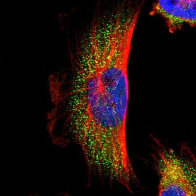 Immunocytochemistry/Immunofluorescence: PARP14 Antibody [NBP1-93593] - Immunofluorescent staining of human cell line U-251 MG shows localization to cytosol.