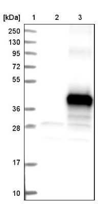 Western Blot: C9orf91 Antibody [NBP1-90535] - Lane 1: Marker [kDa] 250, 130, 95, 72, 55, 36, 28, 17, 10. Lane 2: Negative control (vector only transfected HEK293T lysate). Lane 3: Over-expression lysate (Co-expressed with a C-terminal myc-DDK tag (3.1 kDa) in mammalian HEK293T cells).