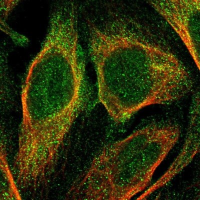 Immunocytochemistry/Immunofluorescence: C9orf91 Antibody [NBP1-90535] - Staining of human cell line U-2 OS shows localization to plasma membrane & cytosol.