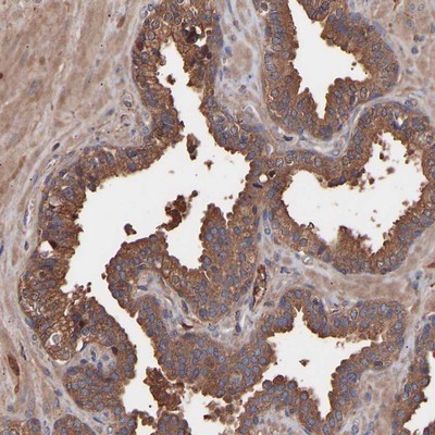 Immunohistochemistry-Paraffin: C9orf91 Antibody [NBP1-90535] - Staining of human prostate shows strong cytoplasmic positivity in glandular cells.