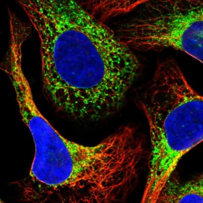 Immunocytochemistry/Immunofluorescence: PDIA6 Antibody [NBP2-38213] - Immunofluorescent staining of human cell line U-2 OS shows localization to endoplasmic reticulum.