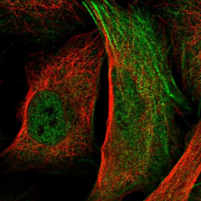 Immunocytochemistry/Immunofluorescence: Rpn2 Antibody [NBP2-38323] - Immunofluorescent staining of human cell line U-2 OS shows localization to nucleoplasm & actin filaments.