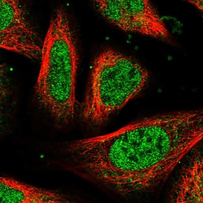 Immunocytochemistry/Immunofluorescence: UROS Antibody [NBP1-92565] - Immunofluorescent staining of human cell line U-2 OS shows localization to nucleoplasm & cytosol.