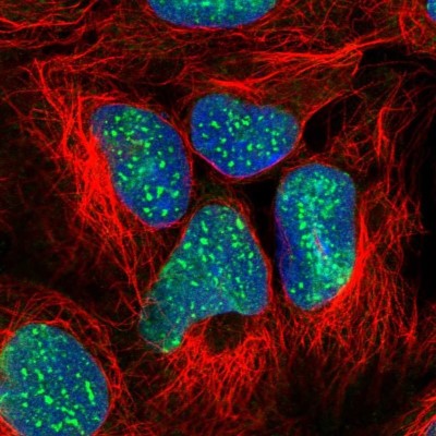 Immunocytochemistry/Immunofluorescence: SUZ12 Antibody [NBP2-33834] - Staining of human cell line HEK 293 shows localization to nucleoli & nuclear bodies.