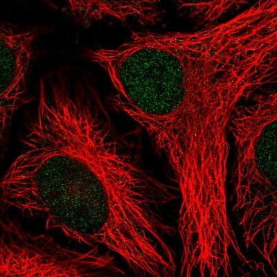 Immunocytochemistry/Immunofluorescence: PTPN14/PTPD2 Antibody [NBP2-38712] - Immunofluorescent staining of human cell line HeLa shows localization to nucleoplasm.