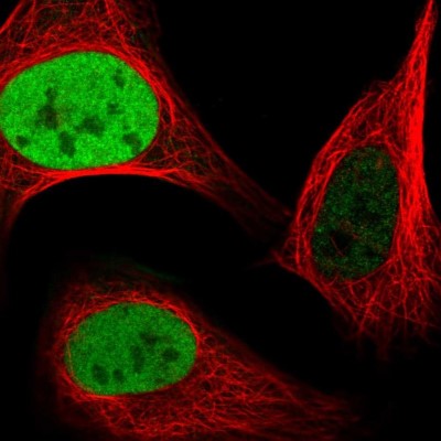 Immunocytochemistry/Immunofluorescence: Anillin Antibody [NBP2-38630] - Immunofluorescent staining of human cell line U-2 OS shows localization to nucleoplasm.