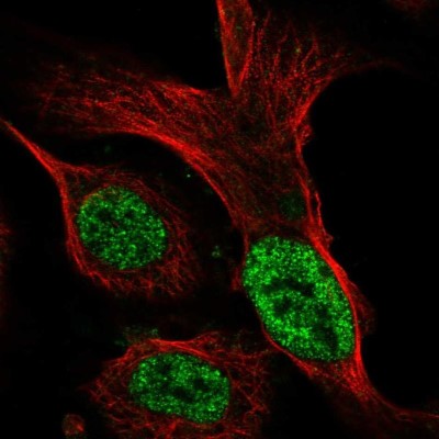Immunocytochemistry/Immunofluorescence: ST6GALNAC3 Antibody [NBP2-31603] - Staining of human cell line U-2 OS shows localization to nucleoplasm.
