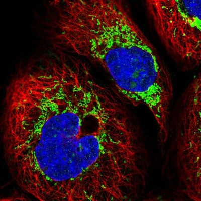 Immunocytochemistry/Immunofluorescence: KCTD6 Antibody [NBP2-38281] - Immunofluorescent staining of human cell line A-431 shows localization to nucleoli & mitochondria.