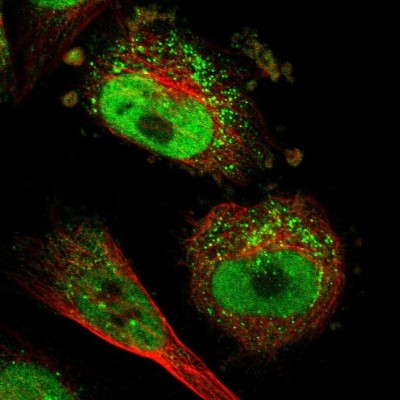 Immunocytochemistry/Immunofluorescence: PTIP Antibody [NBP2-33877] - Staining of human cell line U-251 MG shows positivity in vesicles & nucleus but excluded from the nucleoli.