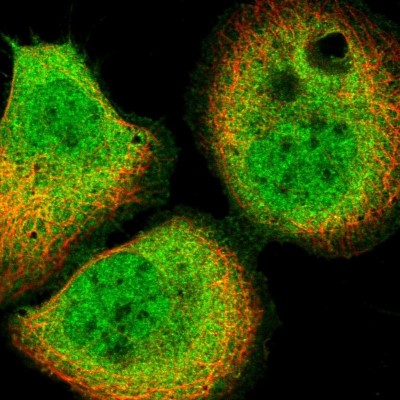 Immunocytochemistry/Immunofluorescence: SAPS3 Antibody [NBP2-34049] - Immunofluorescent staining of human cell line A-431 shows localization to nucleoplasm, plasma membrane & cytosol.