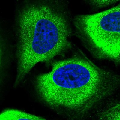 Immunocytochemistry/Immunofluorescence: GPX8 Antibody [NBP2-48664] - Immunofluorescent staining of human cell line HeLa shows localization to cytosol & actin filaments.