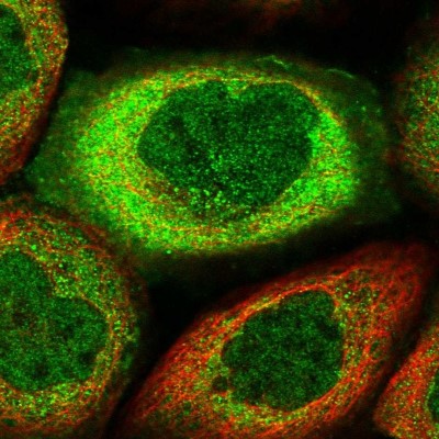 Immunocytochemistry/Immunofluorescence: MIER2 Antibody [NBP2-47372] - Immunofluorescent staining of human cell line A-431 shows localization to nucleoplasm & cytosol.