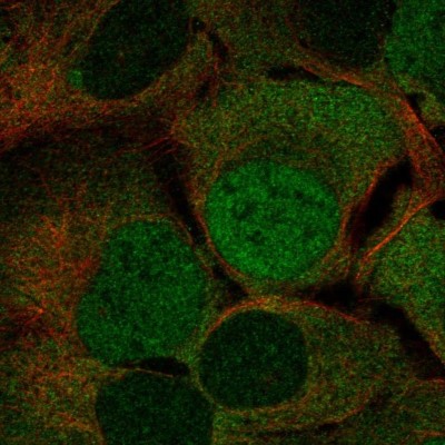 Immunocytochemistry/Immunofluorescence: GET4 Antibody [NBP1-86732] - Staining of human cell line U-2 OS shows localization to nucleoplasm & cytosol.