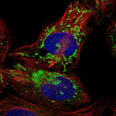 Immunocytochemistry/Immunofluorescence: PPM1K Antibody [NBP1-85035] - Immunofluorescent staining of human cell line U-2 OS shows localization to mitochondria.