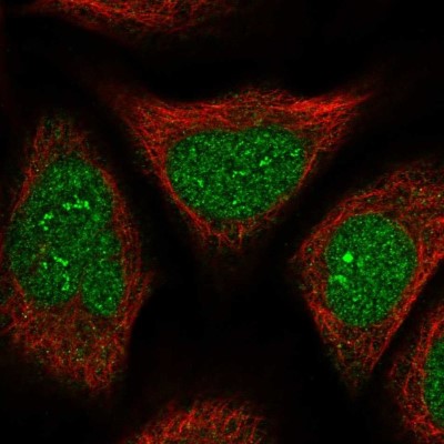 Immunocytochemistry/Immunofluorescence: FAM76B Antibody [NBP2-32670] - Staining of human cell line U-2 OS shows localization to nucleus, nucleoli fibrillar center & nuclear membrane.