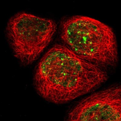 Immunocytochemistry/Immunofluorescence: RAD18 Antibody [NBP2-33865] - Staining of human cell line A-431 shows positivity in nucleus but excluded from the nucleoli.