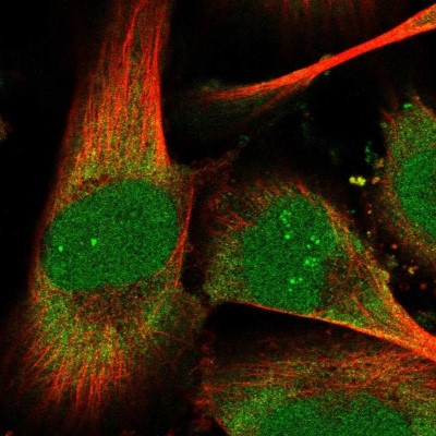 Immunocytochemistry/Immunofluorescence: THYN1 Antibody [NBP2-32645] - Staining of human cell line U-251 MG shows localization to nucleus, nucleoli fibrillar center & cytosol.