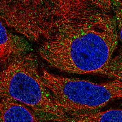 Immunocytochemistry/Immunofluorescence: STAM-1 Antibody [NBP2-38514] - Immunofluorescent staining of human cell line CACO-2 shows localization to vesicles.