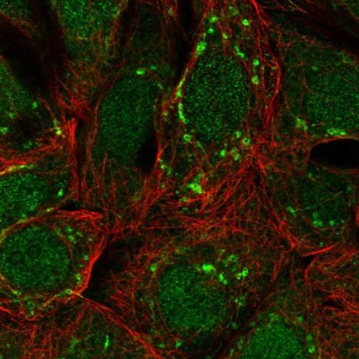 Immunocytochemistry/Immunofluorescence: ARFIP1 Antibody [NBP2-38342] - Staining  of human cell line MCF7 shows positivity in nucleus, the Golgi apparatus and vesicles.