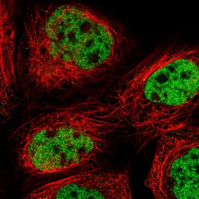 Immunocytochemistry/Immunofluorescence: FoxK1 Antibody [NBP1-83109] - Immunofluorescent staining of human cell line A-431 shows localization to nucleoplasm.