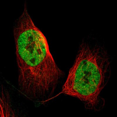 Immunocytochemistry/Immunofluorescence: DGCR14 Antibody [NBP1-84258] - Immunofluorescent staining of human cell line U-2 OS shows localization to nucleoplasm.