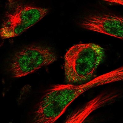 Immunocytochemistry/Immunofluorescence: HOXC11 Antibody [NBP1-83230] - Staining of human cell line U-251 MG shows localization to nucleoplasm & cytosol.